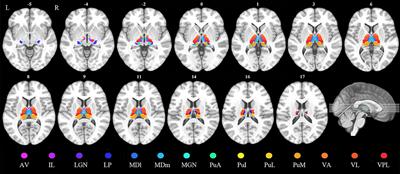 More Than Just Static: Dynamic Functional Connectivity Changes of the Thalamic Nuclei to Cortex in Parkinson's Disease With Freezing of Gait